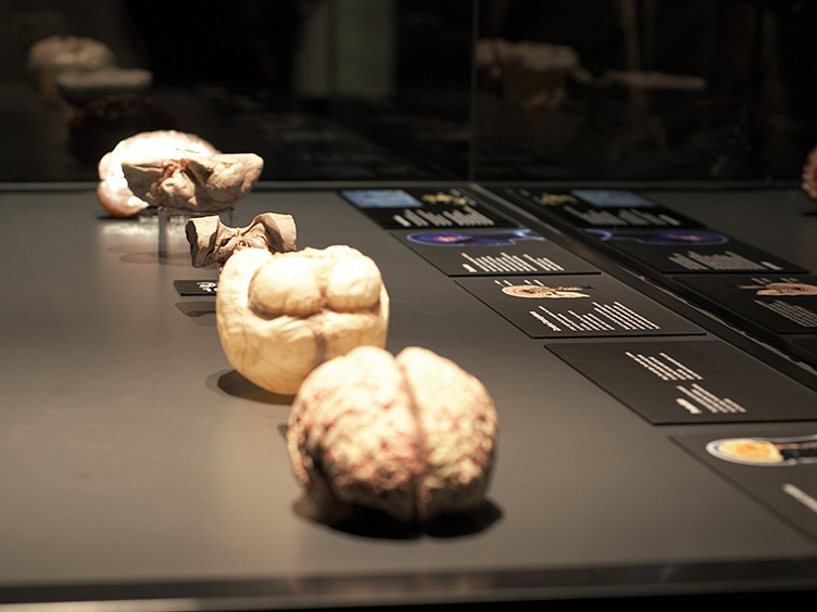 BODY WORLDS Amsterdam brains